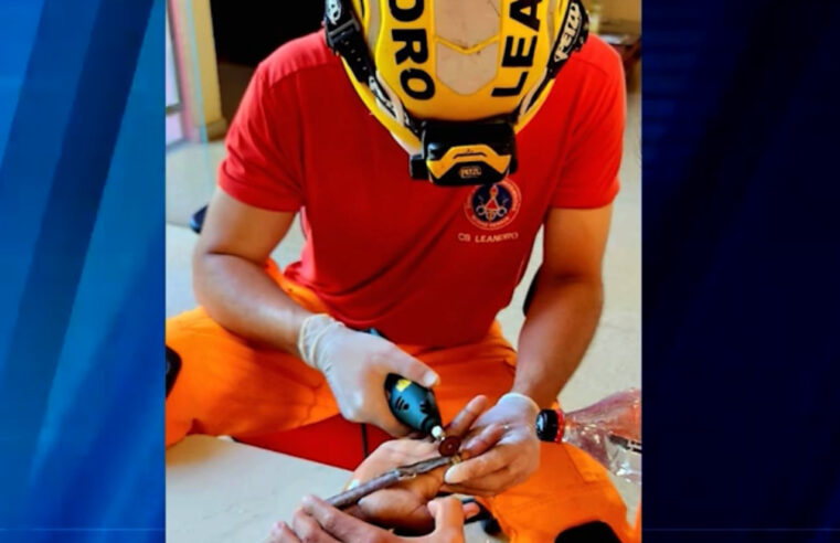 Adolescente tem dedo estrangulado por anel