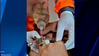 Homem tem dedo estrangulado por aliança ao descer de caminhão